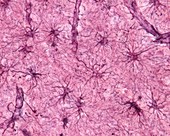 Astrocytes, light micrograph