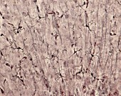 Microglia, light micrograph