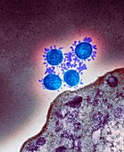 Covid-19 coronavirus, TEM