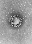 Covid-19 coronavirus, TEM