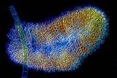Batrachospermum alga and Fragilaria diatom, light micrograph