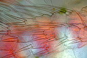 Legs of Cyclops copepod, micrograph