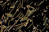 Fragilaria, Cymbella and Synedra diatoms, light micrograph