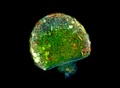 Difflugia testate amoeba, light micrograph