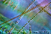 Fragilaria diatoms and filamentous algae, micrograph