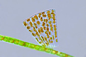 Meridion circulare diatoms, light micrograph