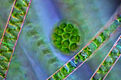 Pandorina and Spirogyra green algae, light micrograph