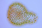Uroglena alga, light micrograph
