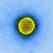 Covid-19 coronavirus, TEM