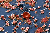 Red blood cell and platelets, SEM