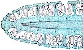 Horsetail (Equisetum sp.) mature strobilus, light micrograph