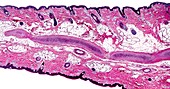 Mammal skin showing hair follicles, light micrograph