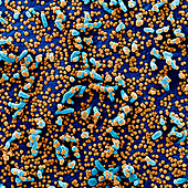 Covid-19 coronavirus particles, SEM