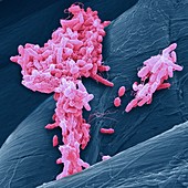 Salmonella bacteria, SEM