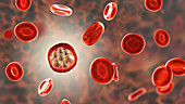 Malaria infection, illustration