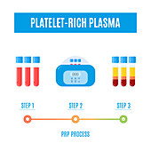 Platelet-rich plasma procedure, illustration
