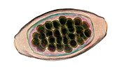 Eggs of a parasitic worm Trichuris trichiura, illustration