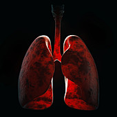 Lung infection, illustration