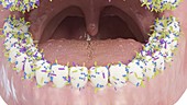 Bacteria on teeth, illustration
