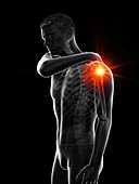 Painful shoulder joint, illustration