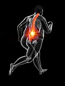 Obese runner's painful back, illustration