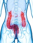 Diseased colon, illustration