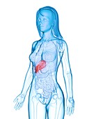 Diseased liver, illustration