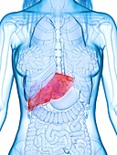 Diseased liver, illustration