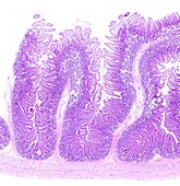 Jejunum, light micrograph