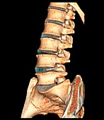 Healthy lower spine, 3D CT scan