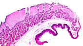 Human epiglottis, light micrograph