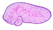 Human adrenal gland, light micrograph