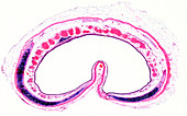 Human trachea, light micrograph