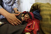 Malnourished baby, Afghanistan