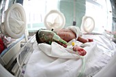 Baby in incubator, Afghanistan