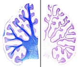 Cerebellum, light micrographs