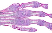 Developing hand bones, light micrograph