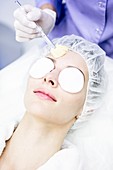 Facial microdermabrasion treatment