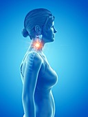 Woman with a painful neck, illustration