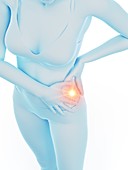 Woman with a painful hip, illustration