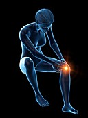 Woman with a painful knee, illustration