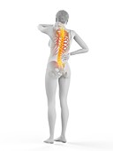 Woman with backache, illustration