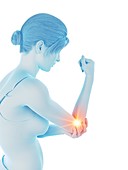 Woman with a painful elbow, illustration