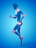 Woman with painful joints while walking, illustration