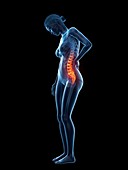 Woman with a painful back, illustration