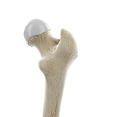 Upper femur joint, illustration