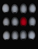 A dozen eggs, X-ray