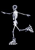 Skeleton in-line skating, X-ray