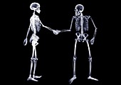 Two skeletons shaking hands, X-ray