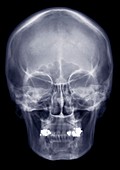 Human skull from front, X-ray